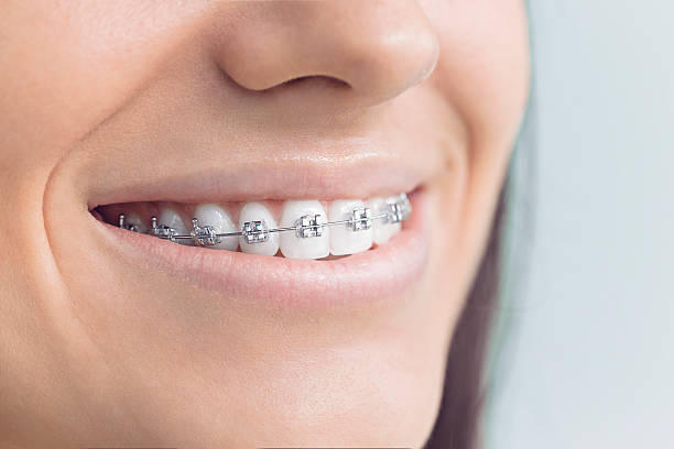 Best Dental Inlays and Onlays  in Orangevale, CA
